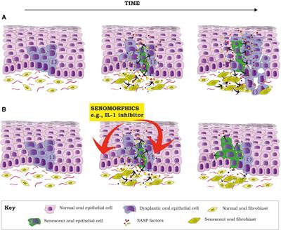 Aging and oral squamous cell carcinoma development: the role of cellular senescence